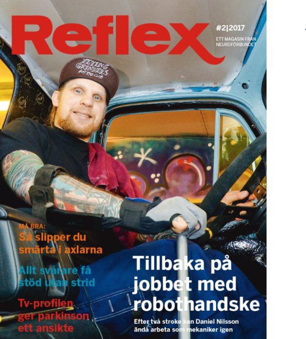 Reflex